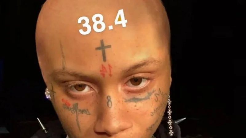 The core meme: 38.4 on forehead.