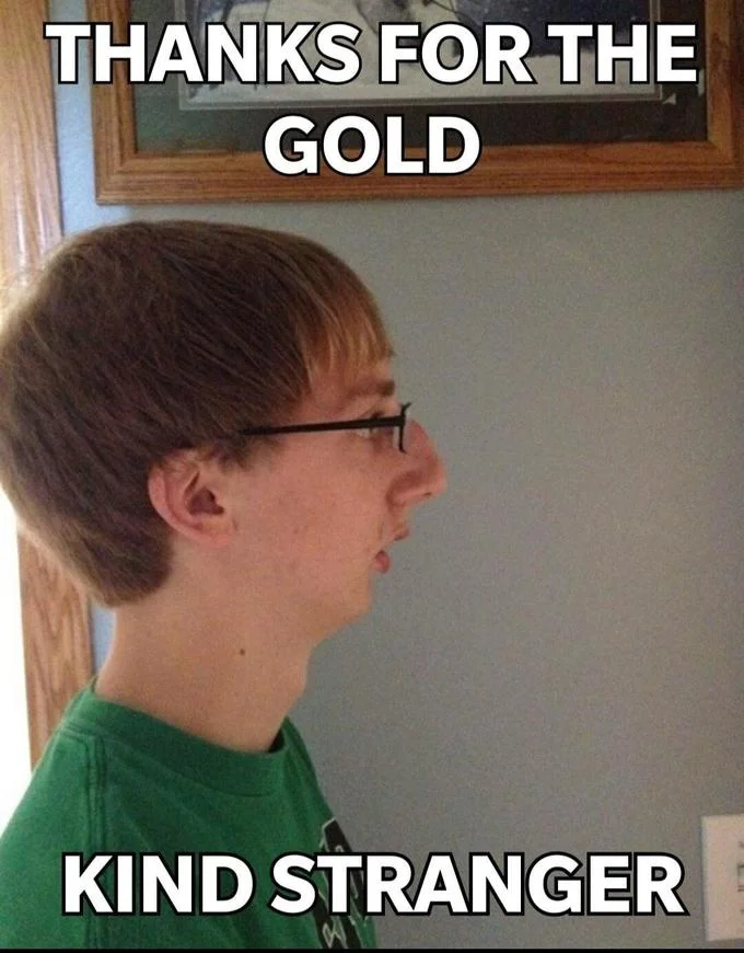 One of the earliest widely shared photographic examples of the chinlet look, based on the 'Thanks for the gold' Reddit image macro.