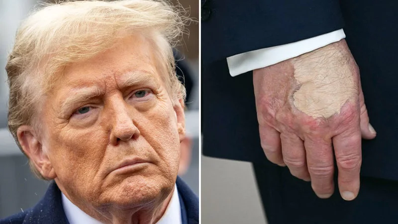 Composite of face and hand makeup imagery.