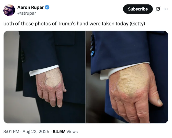 Viral hand makeup comparison photos.