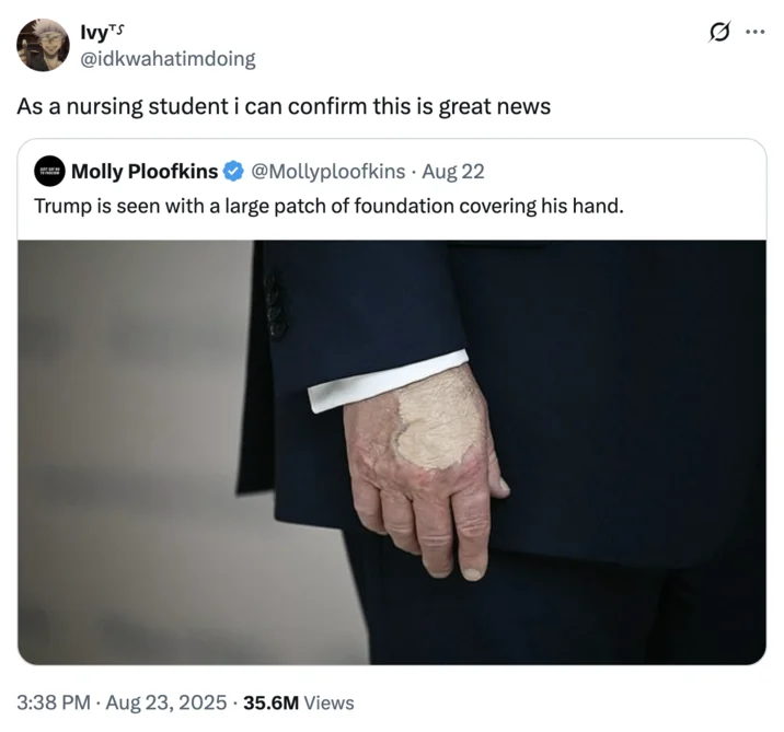 Nursing perspective on hand makeup appearance.