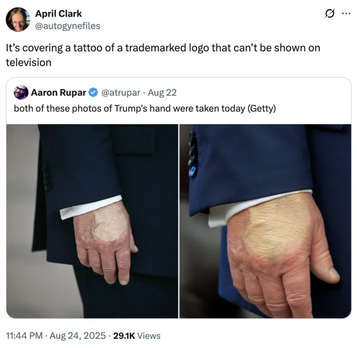 Donald Trumps Hand Makeup And Death Speculation