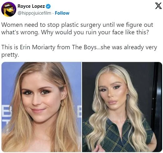 A widely shared Royce Lopez tweet arguing against plastic surgery, using Erin Moriarty as an example.