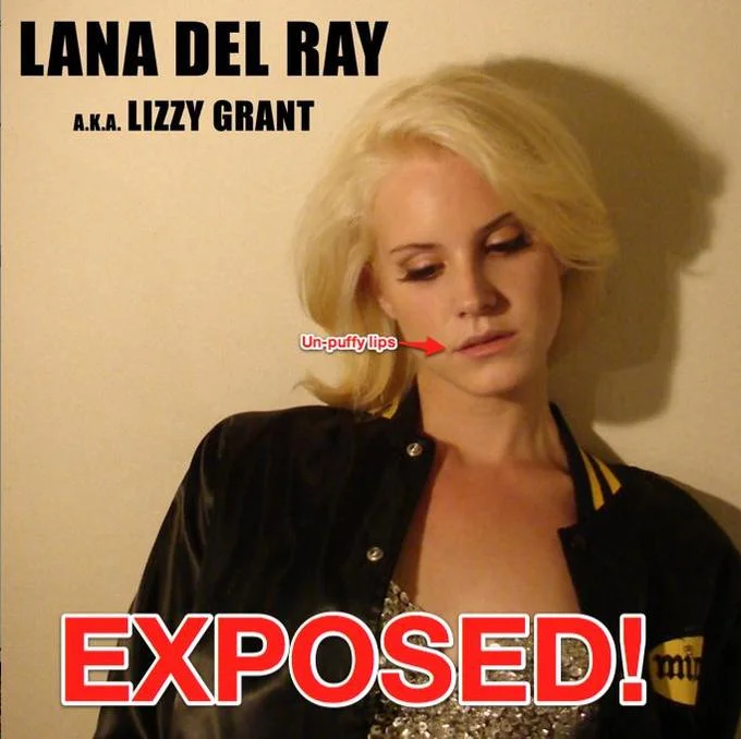 A viral 'Exposed!' image contrasting Lana Del Rey's current look with her earlier Lizzy Grant days, fueling authenticity and cosmetic surgery debates.