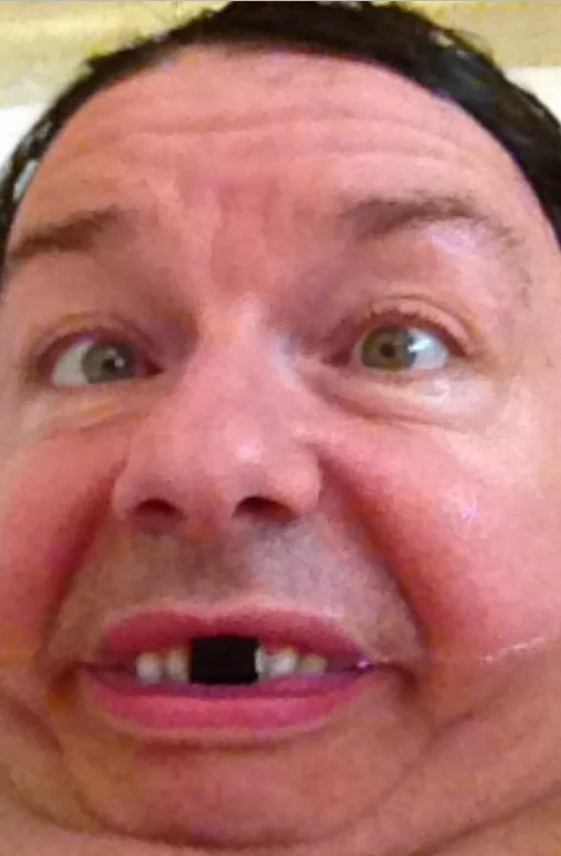 Ricky Gervais mugs for the camera with a blacked-out tooth in another entry from his series of goofy self-portraits.