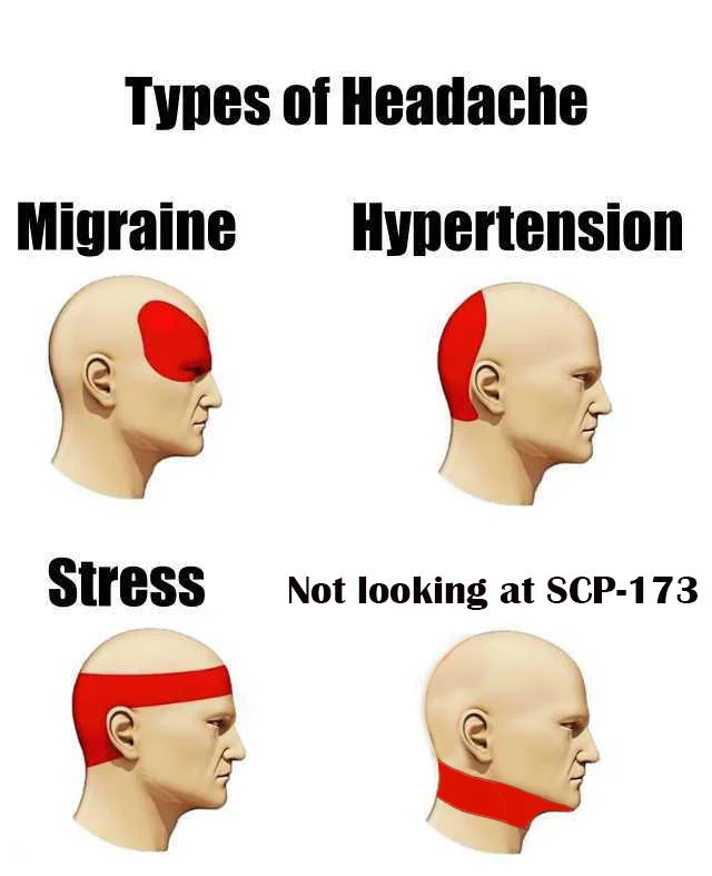 New headache category: SCP-173 awareness anxiety.