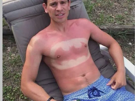 A Batman logo produced through sunburn art, one of the popularized examples of the trend.
