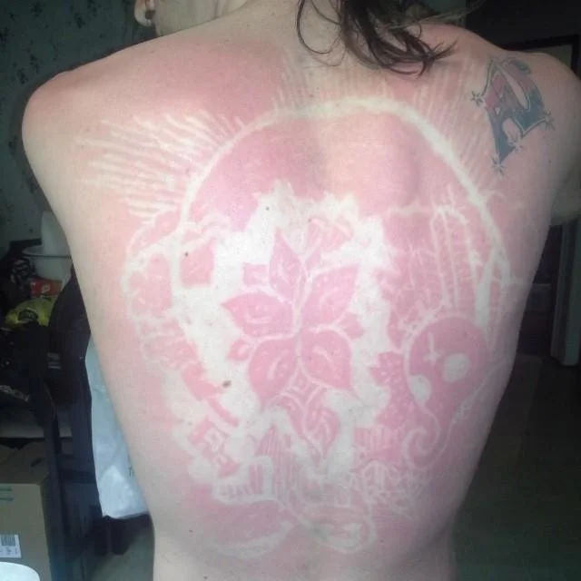An elaborate floral mandala sunburn art design created by stenciling the skin before sun exposure.