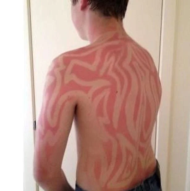An intricate tribal-style sunburn art design covering the entire back and torso.