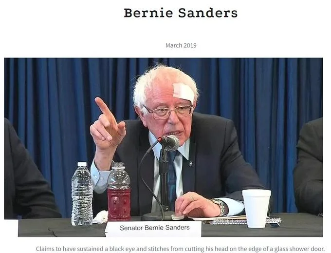 Bernie Sanders appearing at a March 2019 press event with a bandaged eyebrow and black eye, another Black Eye Club example.