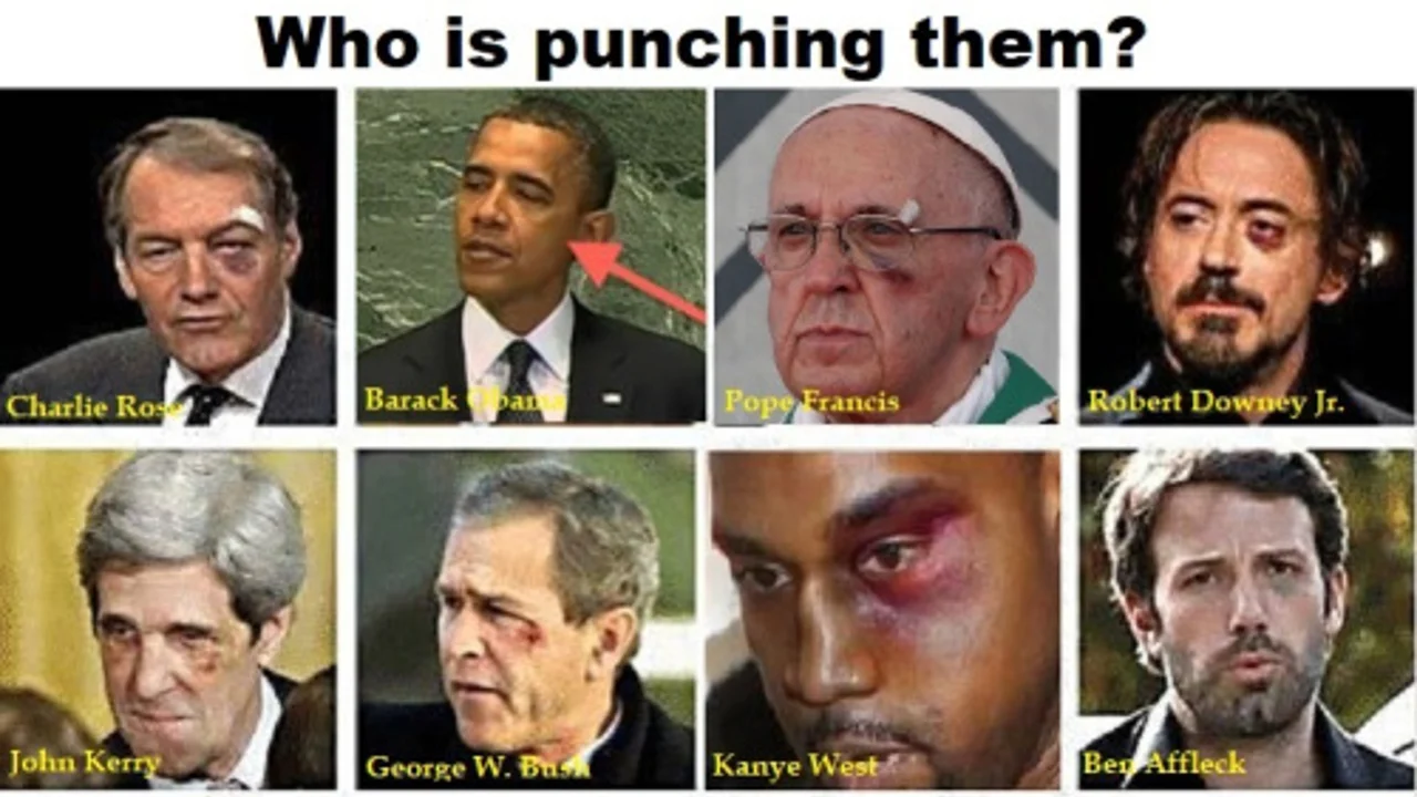 The 'Black Eye Club' collage showcasing well-known public figures who have all mysteriously appeared with black eyes and facial injuries.