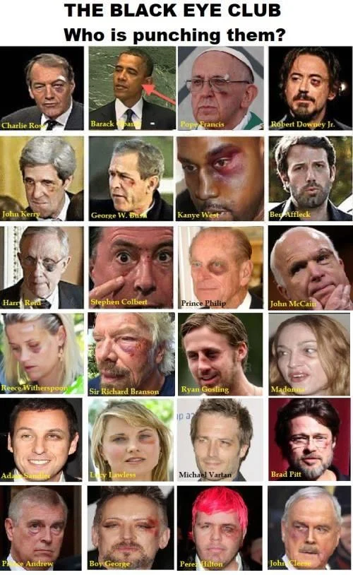 A larger version of the Black Eye Club collage featuring 24 public figures with unexplained facial injuries.