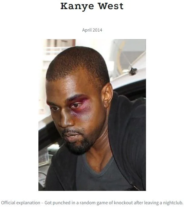 Kanye West sporting a black eye in April 2014, one of the most iconic examples cited by Black Eye Club conspiracy theorists.