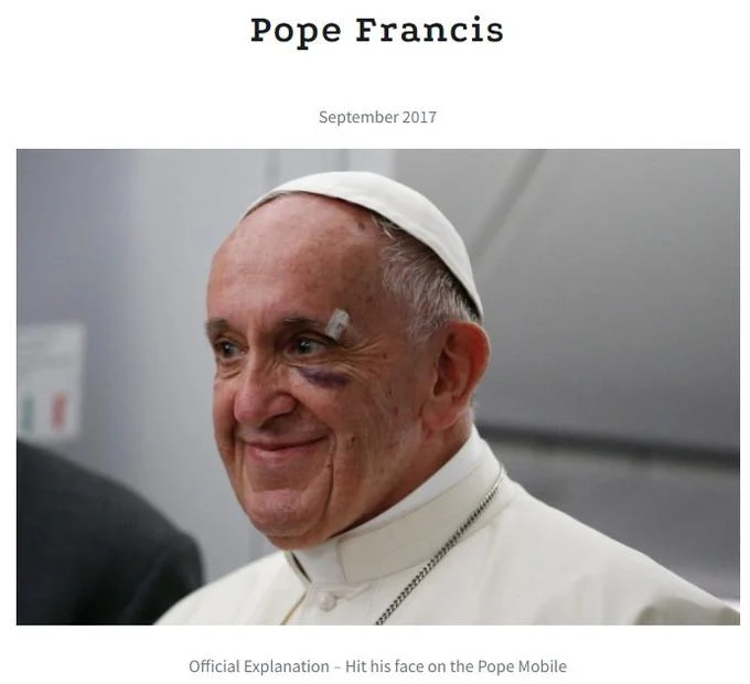 Pope Francis with a black eye in September 2017, reportedly from hitting his face on the Pope Mobile.